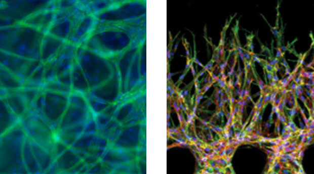 Directing vascular network growth using nutrient concentration gradients is a strategy that Livermore is pursuing to create a hierarchical network similar to that naturally formed in the human body. (left) An equal distribution of nutrients results in a spaghetti-like vascular network, whereas (right) a gradient in nutrition concentration creates a greater density of blood-vessel analogues where nutrients are denser. (Image on right courtesy of the Royal Society of Chemistry.) 