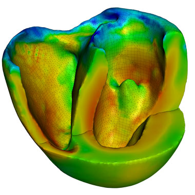 Developed by Lawrence Livermore and IBM to run on Sierra’s predecessor, Sequoia, the highly scalable and complex Cardioid code replicates the heart’s electrical system—the current that causes the heart to beat and pump blood through the body. Sierra is expected to enable Cardioid users to run larger ensembles of high-resolution simulations than was ever possible on Sequoia. 